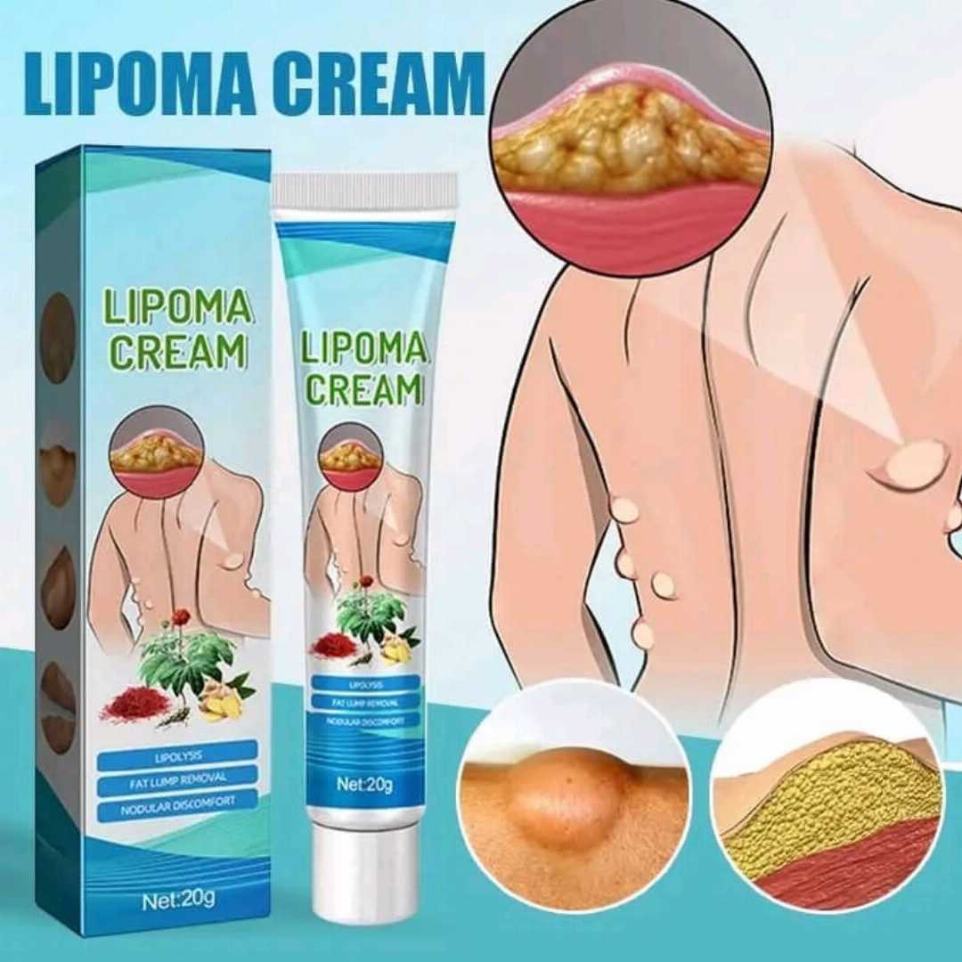 South,Moon™,Lipoma,Treatment,Ointment